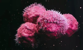 Người phụ nữ được chẩn đoán mắc 12 khối u có đột biến gien chưa từng thấy ở người 