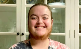 Cô gái 15 năm vật lộn với bộ râu quai nón của mình 