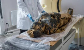 Xác ướp Ai Cập 'Quý bà bí ẩn' có khả năng mắc bệnh ung thư