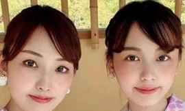 Cặp mẹ con gây 'sốc' khi khiến cộng đồng mạng không phân biệt nổi đâu là mẹ đâu là con