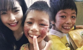 Xúc động cô giáo 9x dùng tiền tiết kiệm nuôi em bé bị lở loét