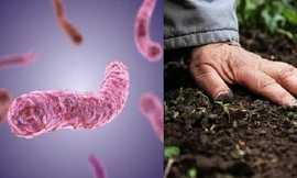  Mẫu đất tại gia đình có 3 trẻ chết chứa khuẩn Whitmore