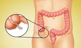 5 công dụng của ruột thừa không phải ai cũng biết