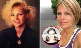 Mắc bệnh hiếm gặp, cơ thể người phụ nữ có mùi cá ươn