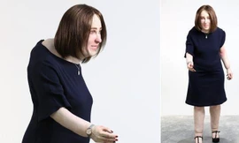 Dân văn phòng 20 năm nữa lưng gù, chân sưng, mắc nhiều bệnh nguy hiểm