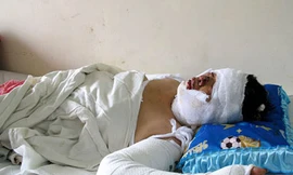 Chồng dùng xăng thiêu vợ