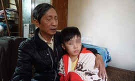 Cháu K. với nhiều vết thương trên người.