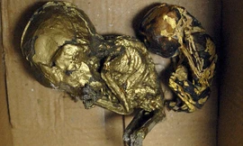 Rùng rợn thai nhi bị sấy khô, dát vàng