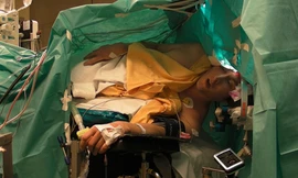 Anh Ambroz Bajec-Lapajne vừa mổ não vừa hát opera