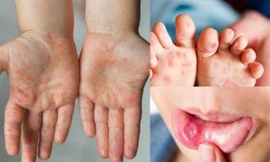 Ảnh minh hoạ: Internet