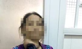 Đắp thuốc ở thầy lang, người phụ nữ vô tình 'nuôi' bướu khổng lồ