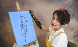 4 lần thoát chết, cô gái trẻ vẫn vững tin vào cuộc sống với cánh tay giả là bạn đồng hành