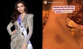 Minh Tú bị vỡ mao mạch vì trời quá lạnh khi thi Hoa hậu siêu quốc gia