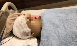 Lộ nguyên nhân Phó Chủ tịch UBND xã ở Hải Dương bị đánh vỡ hộp sọ