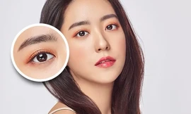 Nhấn mí giá bao nhiêu và nên thực hiện ở đâu?