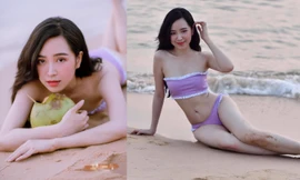Ảnh bikini ‘nóng rực’ của nữ diễn viên ‘Những cô gái trong thành phố’