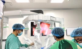 Bác sĩ Bệnh viện K phẫu thuật bằng hệ thống hiện đại nhất hiện nay