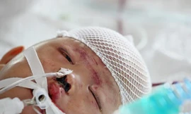 Bé gái hai tuổi bị xe tải đâm đang hồi phục