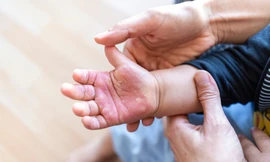 Bác sĩ cảnh báo: Gia tăng trẻ bị tai nạn thời điểm cận Tết 