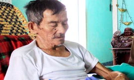 Hai lần bác sĩ bảo chết nhưng vẫn cứ... sống