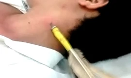 Cây phi tiêu ghim vào cổ anh Trung. Ảnh: Mai Linh.