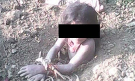 Bé gái Rukshena bị cha chôn xuống hố đất hôm 16/1. Ảnh: NDTV.