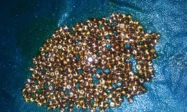 Những viên sỏi nhỏ trong túi mật bà Mousumi Dam. Ảnh: Cover Asia Press.