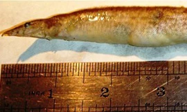 Con lươn trong cổ họng của cậu bé. Nguồn: Daily Mail.