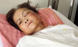 Trên đường ra đám tang đứa con trai vừa qua đời, bà Xéc bị tai nạn. Ảnh:An Nhơn.