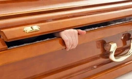 Cụ bà bất ngờ sống lại khi đang tiến hành khâm niệm. Tuy nhiên người ta xác định đây có thể là hiện tượng chết lâm sàng. Ảnh minh họa.