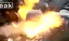 Cháy xém mặt trong lễ sinh nhật