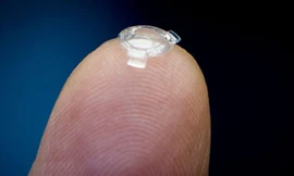 Bác sĩ Garth Webb đặt thấu kính sinh học trên ngón tay. Ảnh: Canadian Press.