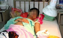 Nam thanh niên tự chặt đứt cánh tay do tiếng nói bên tai xúi giục. Ảnh: Thiên Chương/ Ngoisao.net