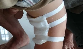 BS tự ý mổ chân phải bé Hào không thông báo gia đình.