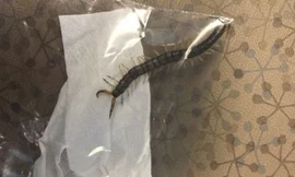 Con rết nhiều chân dài tới hơn 10 cm trong tai cậu bé Grant Botti. Ảnh: Nydailynews.