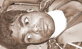 Anh Rajveer Singh đã tỉnh lại trong bệnh viện. Ảnh: Hindustan Times.