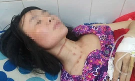 Chị Linh đang được điều trị tại Bệnh viện Đa khoa tỉnh Gia Lai, trên cổ còn nhiều vết bầm tím.