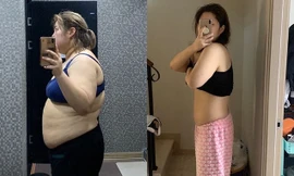 “Thánh ăn” Yang Soo Bin mắc ung thư tuyến giáp do thừa cân hay giảm cân quá nhanh?