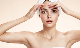 Bạn có bao giờ tự hỏi sao da mặt đã hết mụn rồi, một thời gian sau lại bị trở lại?