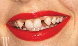 Gucci tiếp tục gây sốc với với hình ảnh mẫu quảng cáo có hàm răng như bị sún