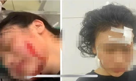 Mẹ nợ tiền, con gái bị rạch mặt 