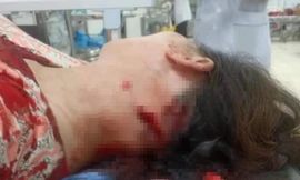 Bà chủ quầy thịt lợn bất ngờ bị người bán hàng rong chém dã man