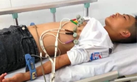 Thầy giáo thể dục bị 'tố' tát học sinh nhập viện