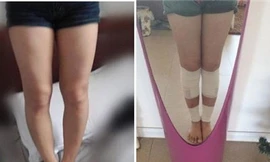 Rợn người cảnh gái trẻ đục chân làm đẹp