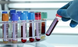 Ảnh minh họa: Internet