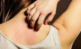 Ảnh minh họa: Internet