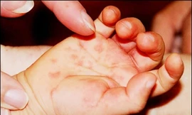 Ảnh minh họa: Internet