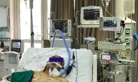 Ảnh: BV cung cấp