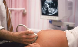 Hơn 40.000 trẻ không được chào đời vì là con gái