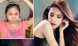 Sao Việt và những hậu quả làm đẹp